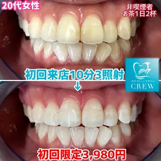 メンズ マツエク・マツパ ホワイトニングサロン CREWのその他イメージ