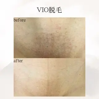 メンズ 歌舞伎町深夜サロン to mëのエステ・リラクイメージ