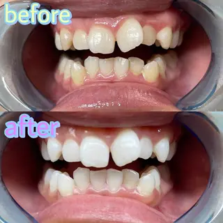 ホワイトニング専門店 LCS 銀座店 峰岡のその他イメージ