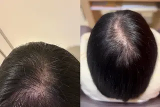 ミディアム 安達 結愛のヘアスタイル