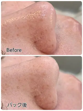 Hisui 種村のエステ・リラクイメージ