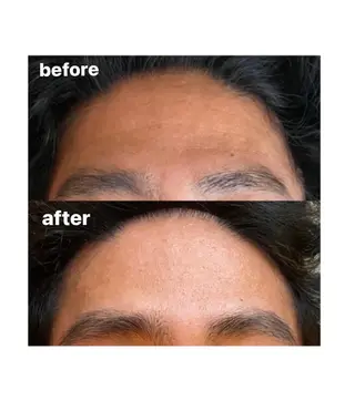 整形級の変化👀 最新✨韓国小顔管理のエステ・リラクイメージ