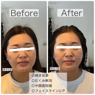 GAGA D Ashのヘアスタイル