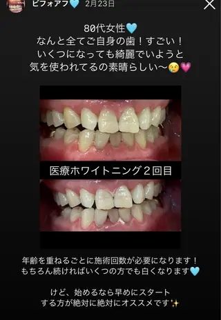 Kaula ホワイトニング🦷✨のエステ・リラクイメージ