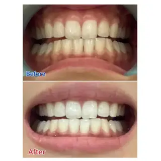 M渋谷 ホワイトニングのエステ・リラクイメージ