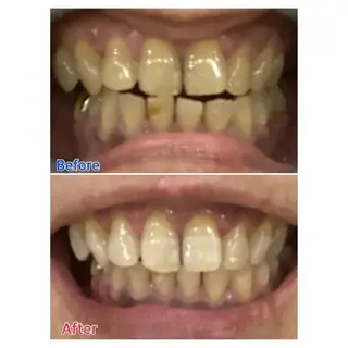 M渋谷 ホワイトニングのエステ・リラクイメージ