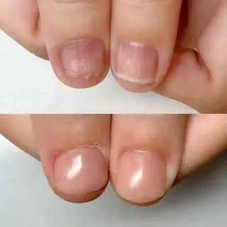 ネイル ネイルサロン アリュームのネイルデザイン