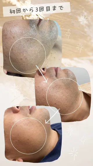 LOWE eyelash&脱毛の眉毛・アイブロウイメージ