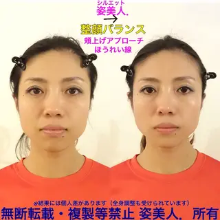 筋膜整体＆小顔矯正 　姿美人.シルエットのエステ・リラクイメージ