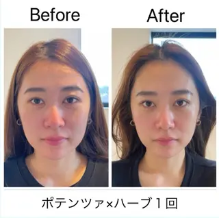 肌管理 OGUMOのエステ・リラクイメージ