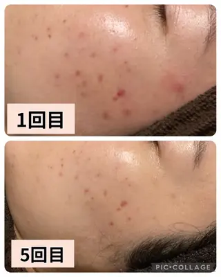 ハーブピーリング 専門／今榮麻美のエステ・リラクイメージ