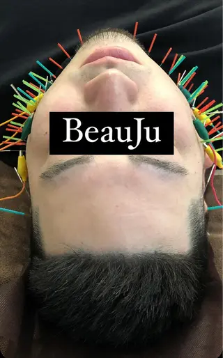 小顔矯/美容鍼/鍼灸 BeauJuのその他イメージ