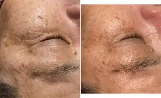 ピーリング専門サロン Spicaのエステ・リラクイメージ