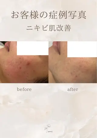 pansy(パンジー)上野フェイシャルエステ専門店所属・pansy フェイシャルエステのエステ・リラクイメージ