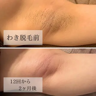 脱毛サロン Arumのエステ・リラクイメージ