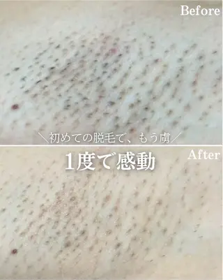 abeshial所属・abeshial 〜美・健康・笑顔〜の眉毛・アイブロウイメージ