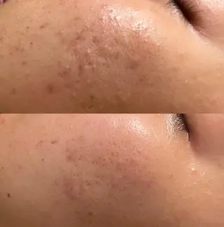 森 美優のエステ・リラクイメージ