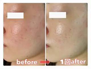 美ola ビオラのエステ・リラクイメージ