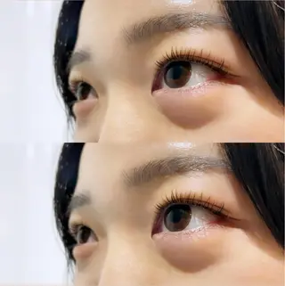 マツエク・マツパ Radiant♡ まつ毛&眉毛サロンのマツエク・マツパデザイン