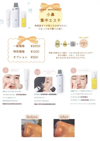 ナリスビューティーステーションデ•アイム西宮所属・都度払いエステ ゆいまーるのエステ・リラクイメージ