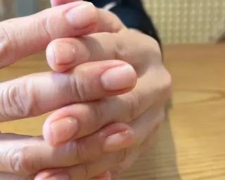 ネイル fote-自爪育成 ネイルケアサロン-のネイルデザイン