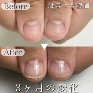 ネイル 深爪専門店 サロンリリーのネイルデザイン