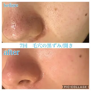 ロング カラー パーマ ヘアアレンジ メンズ ネイル マツエク・マツパ EnsorClair 代表 野口真央のエステ・リラクイメージ