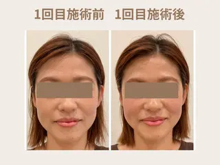 Hana＊ 恵比寿/美容鍼/整体のエステ・リラクイメージ