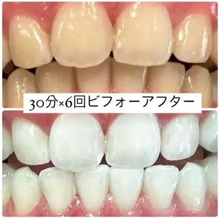 ホワイトニングルーム 横浜店のその他イメージ