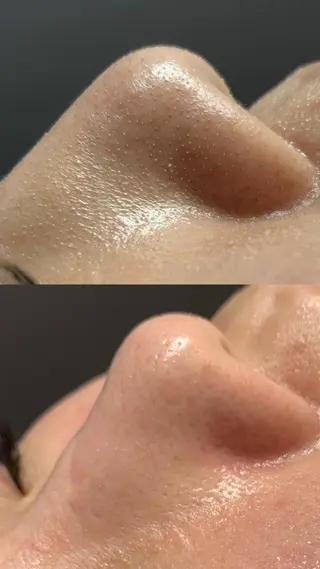 Lilyboo 星のエステ・リラクイメージ