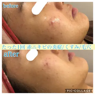ロング カラー パーマ ヘアアレンジ キッズ ネイル マツエク・マツパ EnsorClair 代表 野口真央のエステ・リラクイメージ