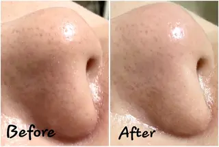 脱毛・ホワイトニング 耳ツボ・美白・毛穴のその他イメージ