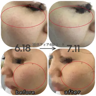 DeI'm 丸亀店所属・いおもり あやかのエステ・リラクイメージ