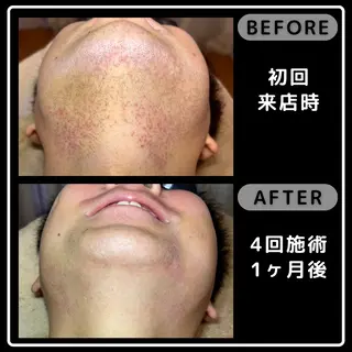 メンズ脱毛サロンReyz（レイズ）所属・メンズ脱毛サロン Reyz（レイズ）のエステ・リラクイメージ