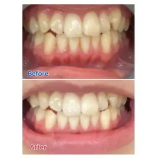 M渋谷 ホワイトニングのエステ・リラクイメージ