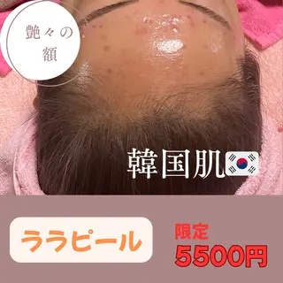 お顔そりシミケア専門店　　せんす所属・韓国肌&ララピール シミケア　せんすのエステ・リラクイメージ