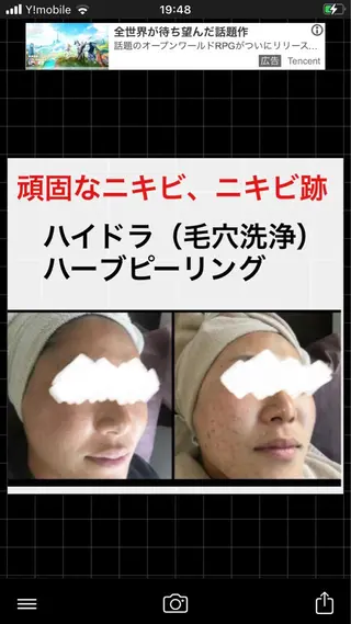 ロング カラー パーマ ヘアアレンジ メンズ キッズ ネイル マツエク・マツパ アイブロウ ハーブピーリング専門 🌿モッカのエステ・リラクイメージ