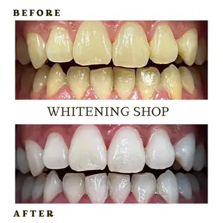 メンズ ホワイトニング ショップ千葉店のその他イメージ