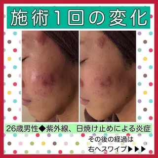 ミディアム カラー パーマ ヘアアレンジ メンズ キッズ ネイル マツエク・マツパ ニキビ・肌質改善専門 ♡人生が変わるサロンのエステ・リラクイメージ