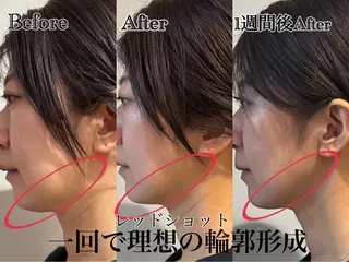 🌸🧡六本木 脱毛しずか🧡🫧の眉毛・アイブロウイメージ