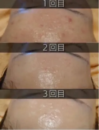 esthesalon O'-en-のエステ・リラクイメージ