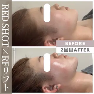 小顔矯正専門店 【RED】池田のエステ・リラクイメージ