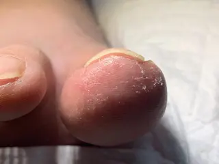 carenail　 tsugumiのその他イメージ