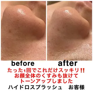 ネイル・エステサロン UILANIのネイルデザイン