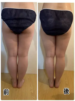 ❤︎MN❤︎ モンのエステ・リラクイメージ