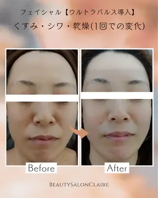 口コミ★5獲得 Claire鈴木のエステ・リラクイメージ