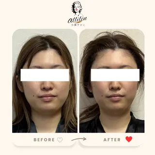 💎allilin 五所川原💎本間のエステ・リラクイメージ