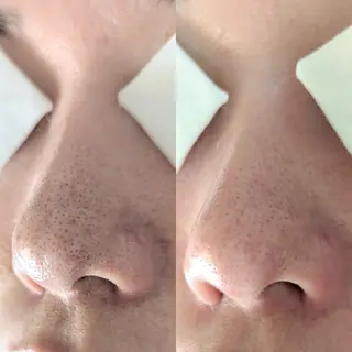  毛穴洗浄・まつ毛 の専門店 ソラーレのエステ・リラクイメージ