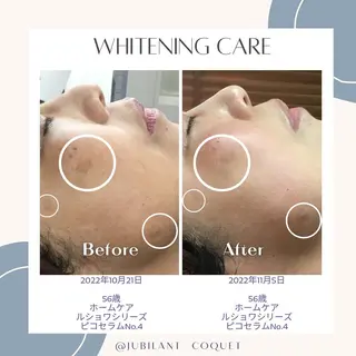 ジュビラン Coquetスタッフのエステ・リラクイメージ