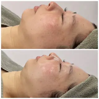 MELIA the beauty所属・肌のお悩み改善サロン MELIA/朋美のエステ・リラクイメージ